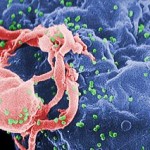 Microscope image of HIV virus attacking cell