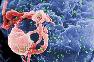 Microscope image of HIV virus attacking cell