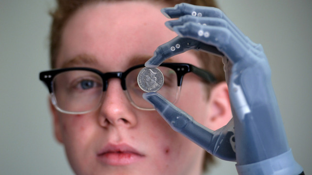 Patrick Kane holding a coin with his iLimb hand