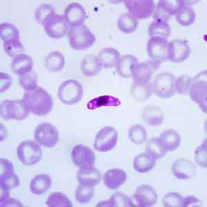 Macrogametocyte_of_the_parasite Plasmodium falciparum