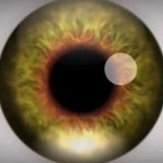 Iris of eye